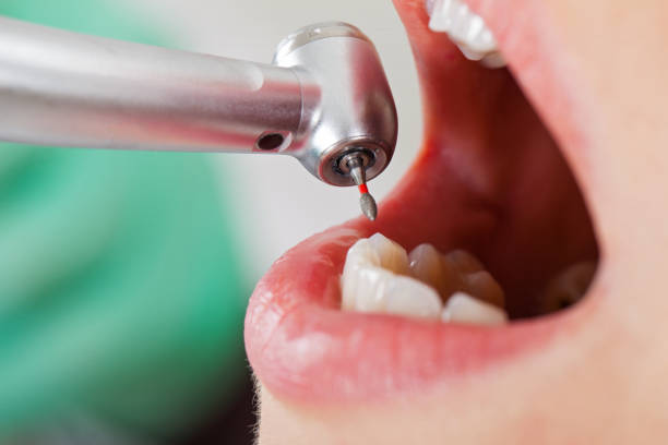 Best Root Canal Emergency Dentist  in Lakes East, CT